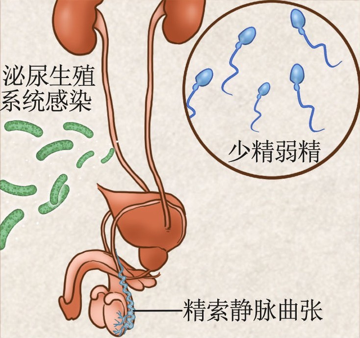西安泌尿生殖医学研究院:从科研到临床的泌尿生殖健康全链条解读